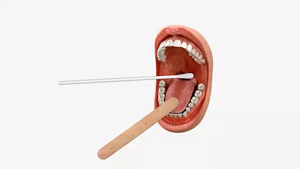 Perform Rapid Strep Test perform-rapid-strep-test
