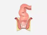 illustration of the rectal area