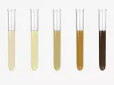 tubes of urine for a urinalysis