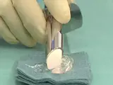 proctoscopy