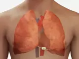 basic ECG view